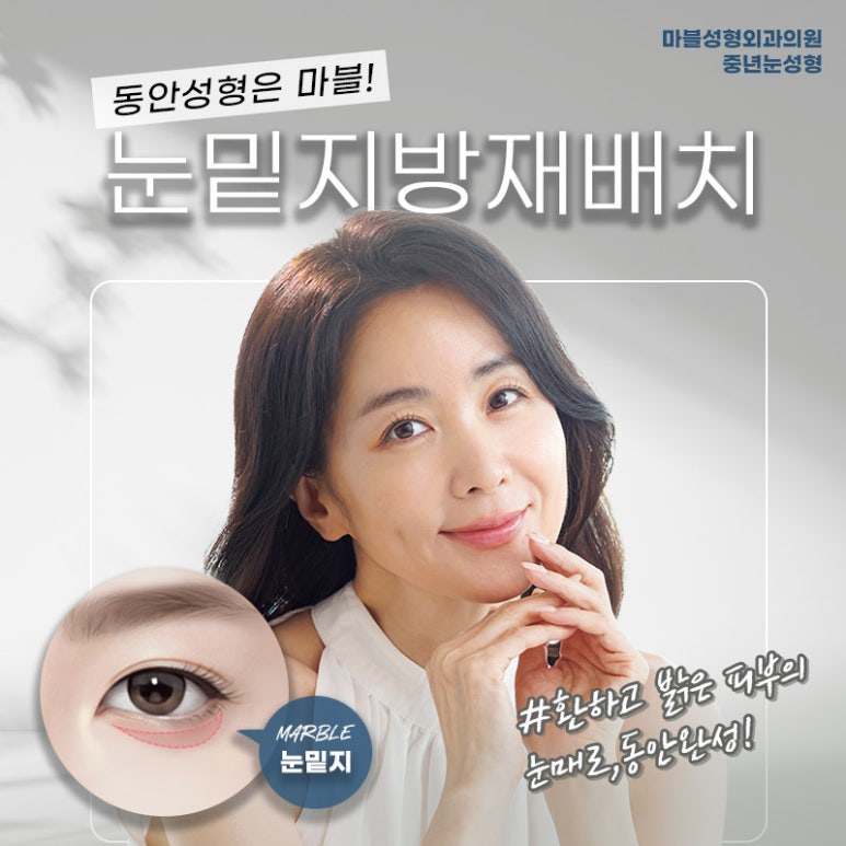 눈밑지방재배치비용 알아볼 때 중요한 것! 마블성형외과 관련 이미지 1
