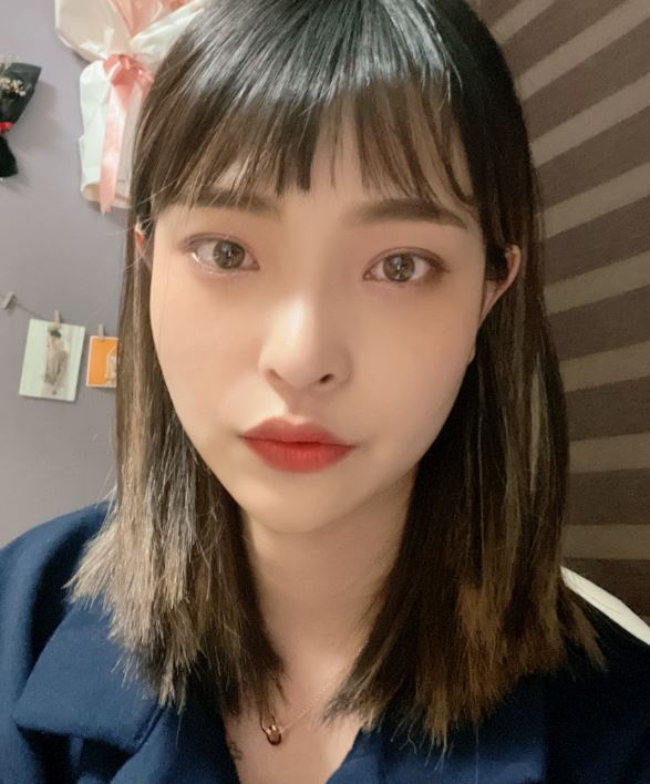 쌍수잘하는곳 수술 전 입문 포인트! 관련 이미지 2