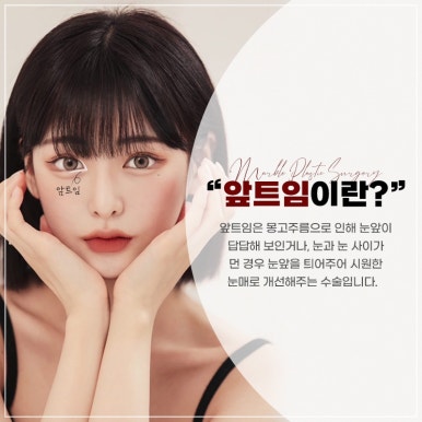 눈성형잘하는병원, 쌍꺼풀수술, 트임수술 관하여 관련 이미지 7