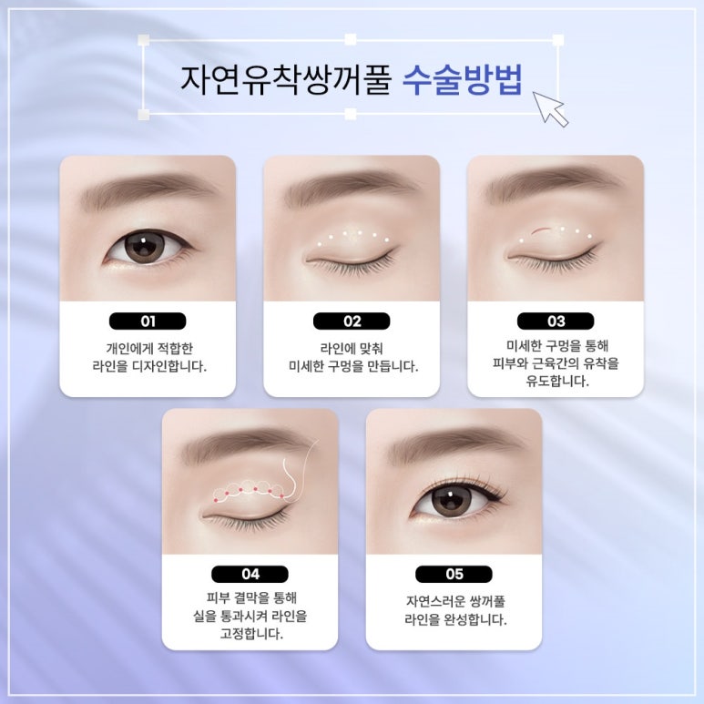 쌍꺼풀수술잘하는곳과 수험생을 위한 수험생이벤트 관련 이미지 2