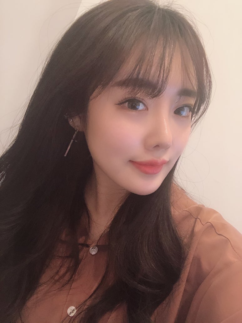 눈밑지방재배치수술후 화사하게 마블성형외과의원 관련 이미지 3