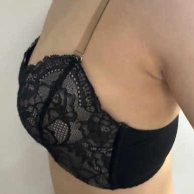 [Gangnam Plastic Surgery Breast Augmentation Real Review] My asymmetry was so severe that my underwear gapedㅠㅠ Customized volumes for each side solved my concern! image 5