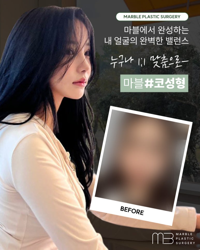 수험생 코성형, 방학동안 안전하게 준비하는 방법 관련 이미지 1
