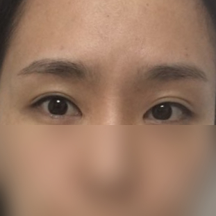 자연유착후기 자연스러워서 맘에 들어요! 관련 이미지 3