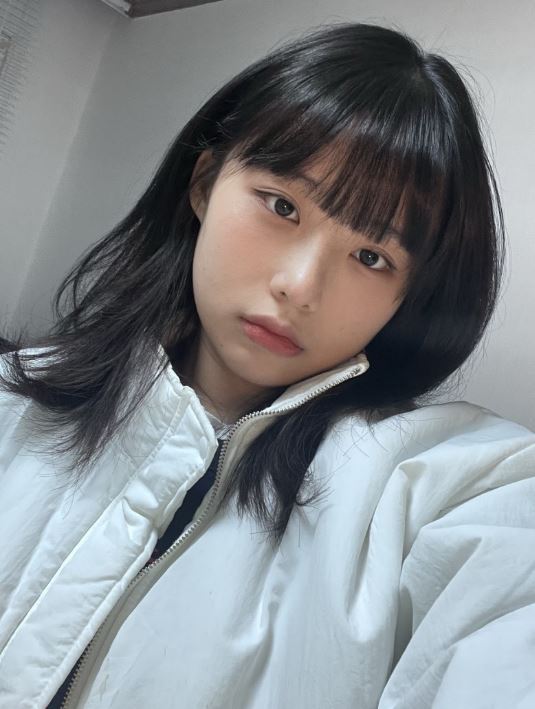 자연유착 쌍꺼풀 인기 많은 이유? 관련 이미지 1