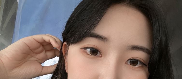 쌍꺼풀 수술후 관리할때 꼭 알아야할것들 관련 이미지 3