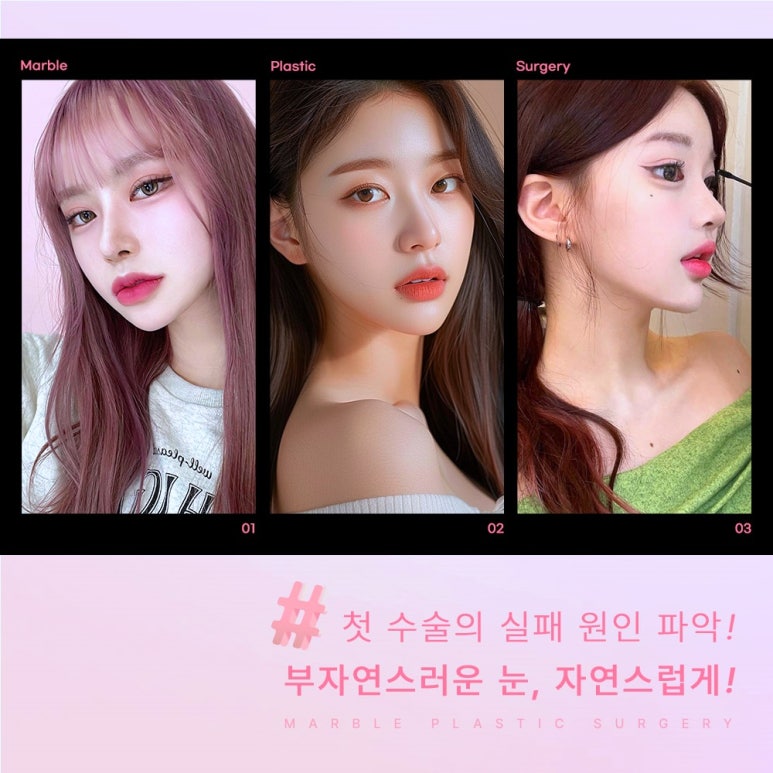 눈재수술 잘 알아봐야 관련 이미지 6