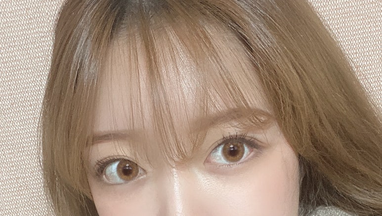 뒤트임후기 흉터 걱정 최소화하기 위해서 관련 이미지 2