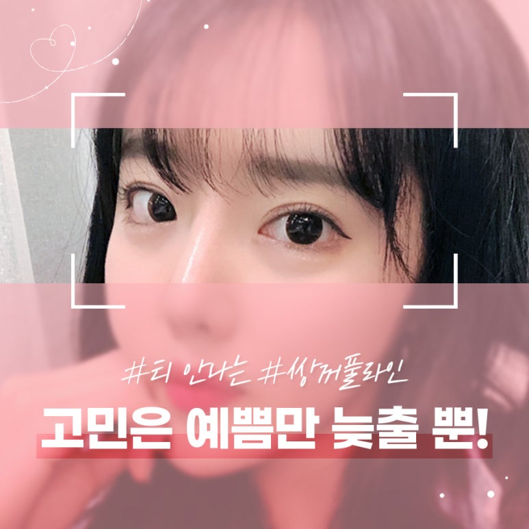 앞트임가격 시원한 눈매로 개선해 관련 이미지 8