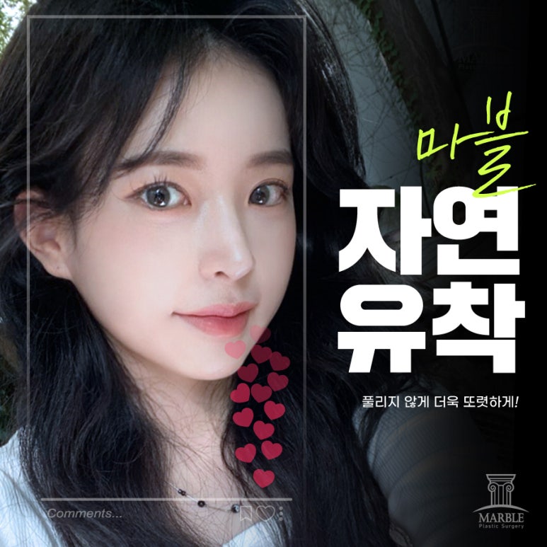 쌍수풀림 처음부터 신중하게 하면 걱정 없이 관련 이미지 6
