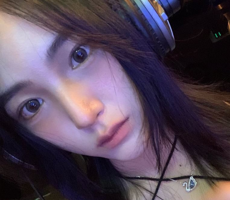 쌍꺼풀풀림 왜 풀리는지 해결 방법은 무엇일까? 관련 이미지 6