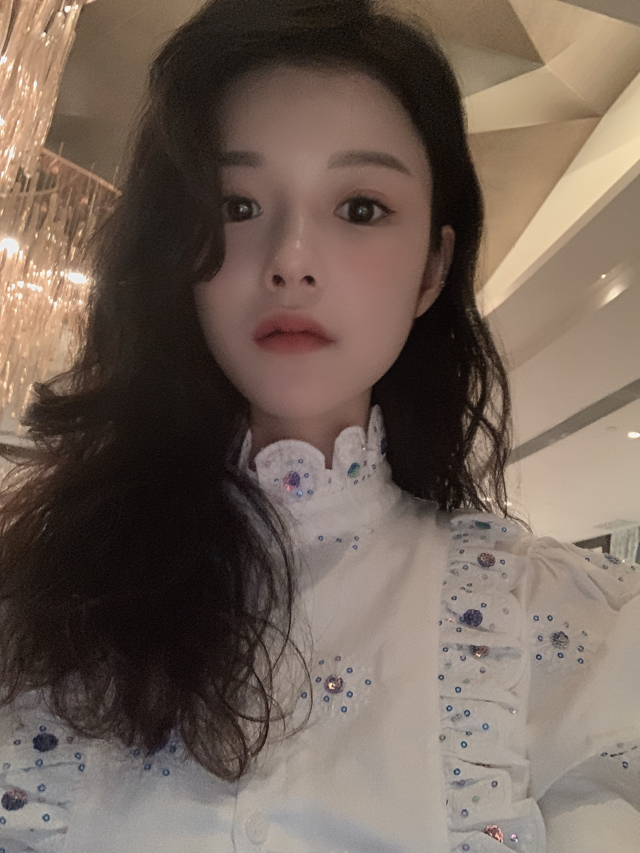 앞트임가격 시원한 눈매로 개선해 관련 이미지 5