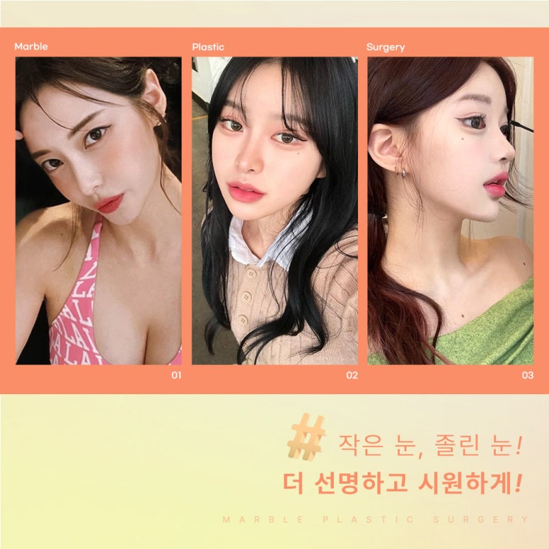 눈매교정비용보다는 결과에 집중하자! 마블성형외과 관련 이미지 8