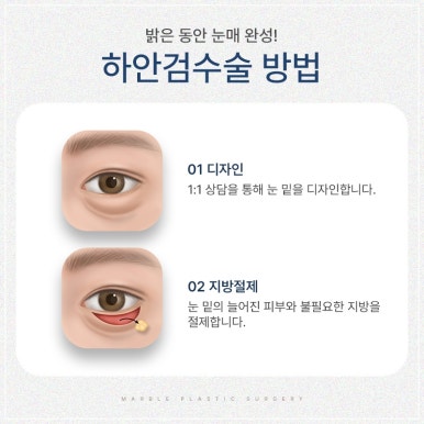 Differences in Lower Eyelid Surgery by Age Group and Recommended Methods: Showing Your Parents Appreciation Through Lower Eyelid Surgery (Before-and-After Photos O) @ Marble Plastic Surgery Clinic image 7