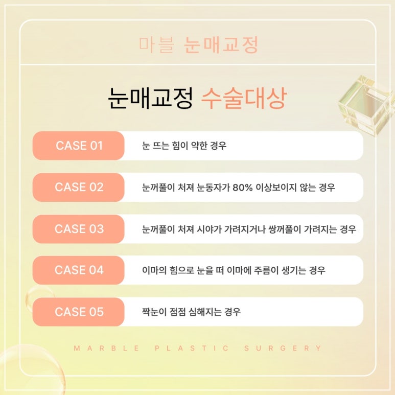 눈매교정 수술, 꼭 필요한가? 관련 이미지 6