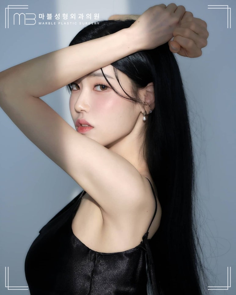 가슴성형흉터 절개 위치별 특징 비교｜마블성형외과 관련 이미지 10