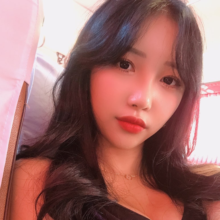 눈밑지방재배치 언제가 좋을까? 관련 이미지 3