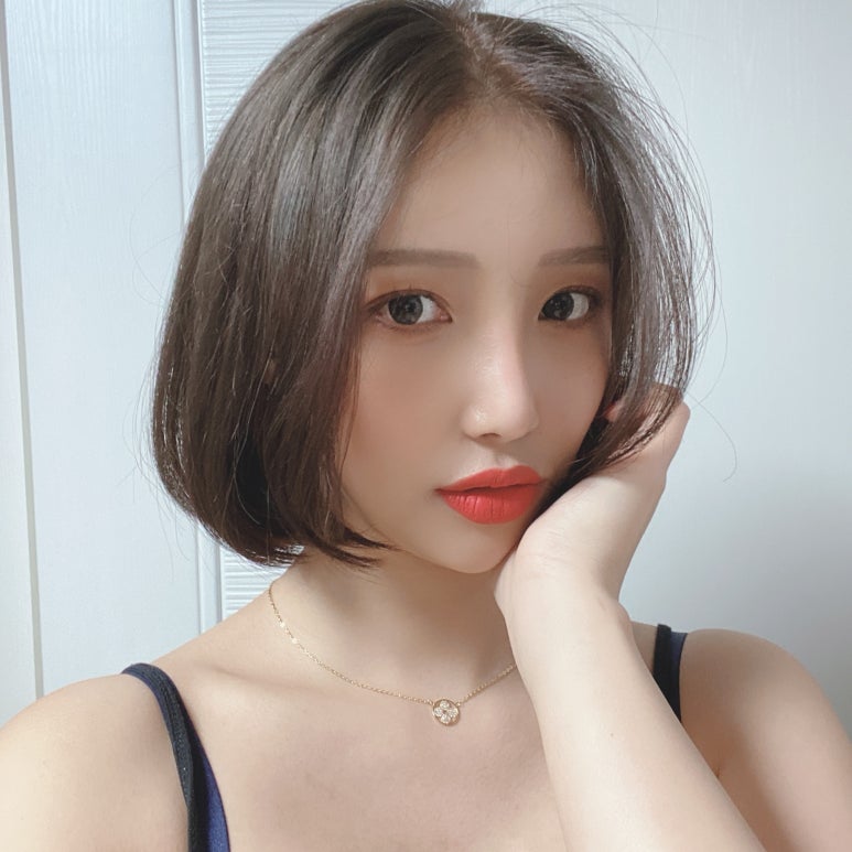 안검하수수술비용 부담되시나요? 관련 이미지 7