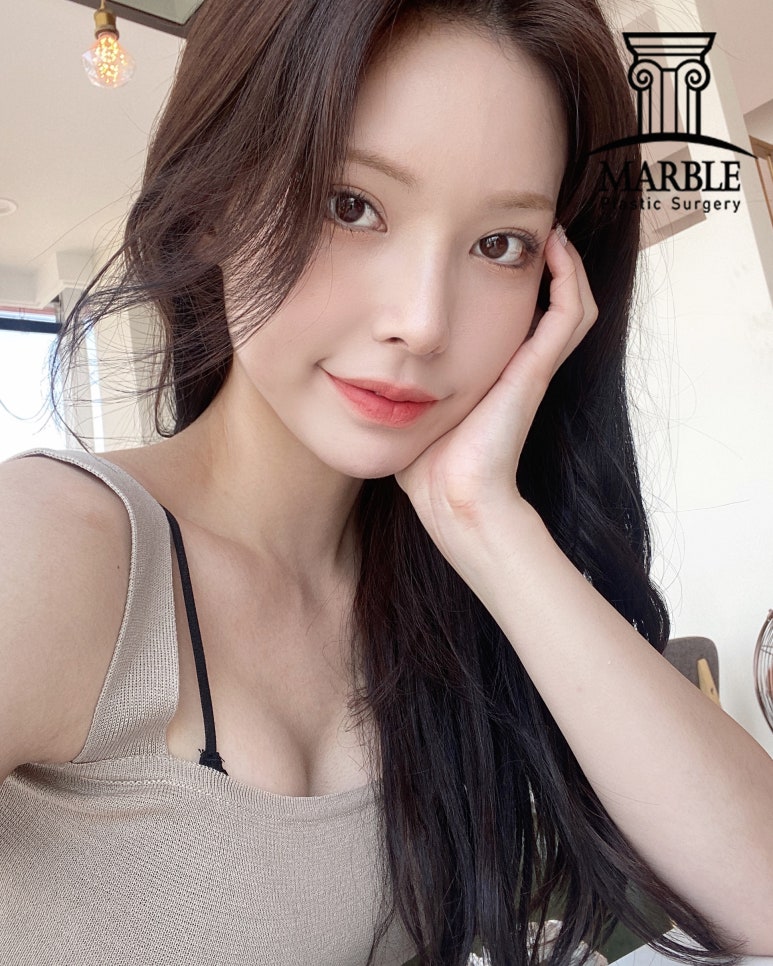 눈수술(눈성형) 후, 알아두면 좋은 주의사항 정리! 관련 이미지 5