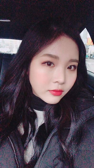 내시경이마거상술 확실한 이마주름제거 가능할까? 마블성형외과의원 관련 이미지 5