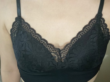 Different Texture and Volume After Breast Surgery with Motiva image 3
