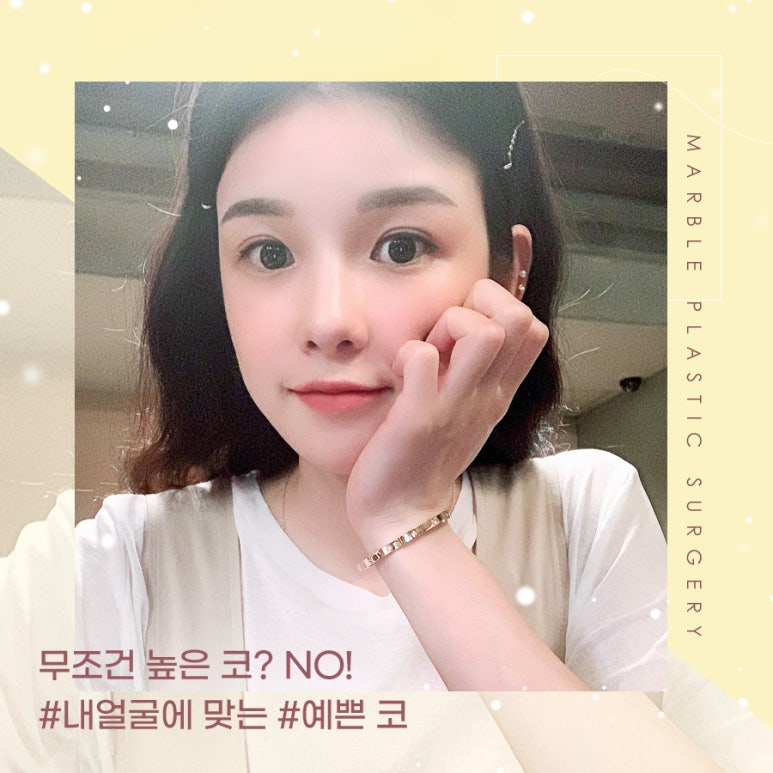 매부리코성형비용 후기까지 살펴보고 관련 이미지 11