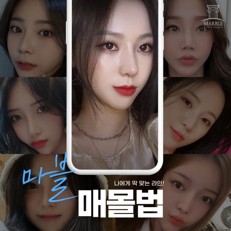 쌍수전후 달라진 눈매 기대한다면 관련 이미지 4