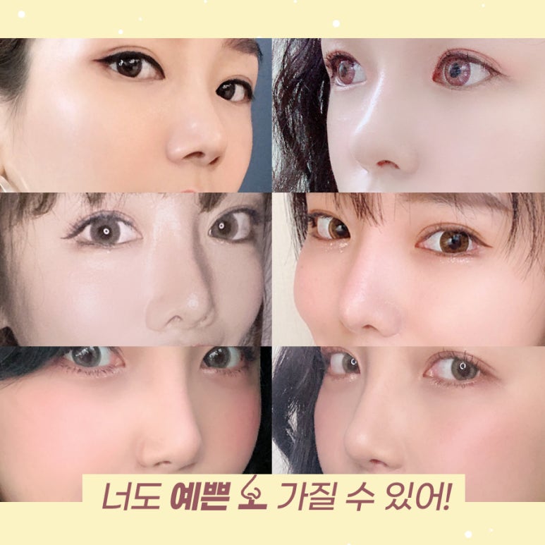매부리코성형비용 후기까지 살펴보고 관련 이미지 12