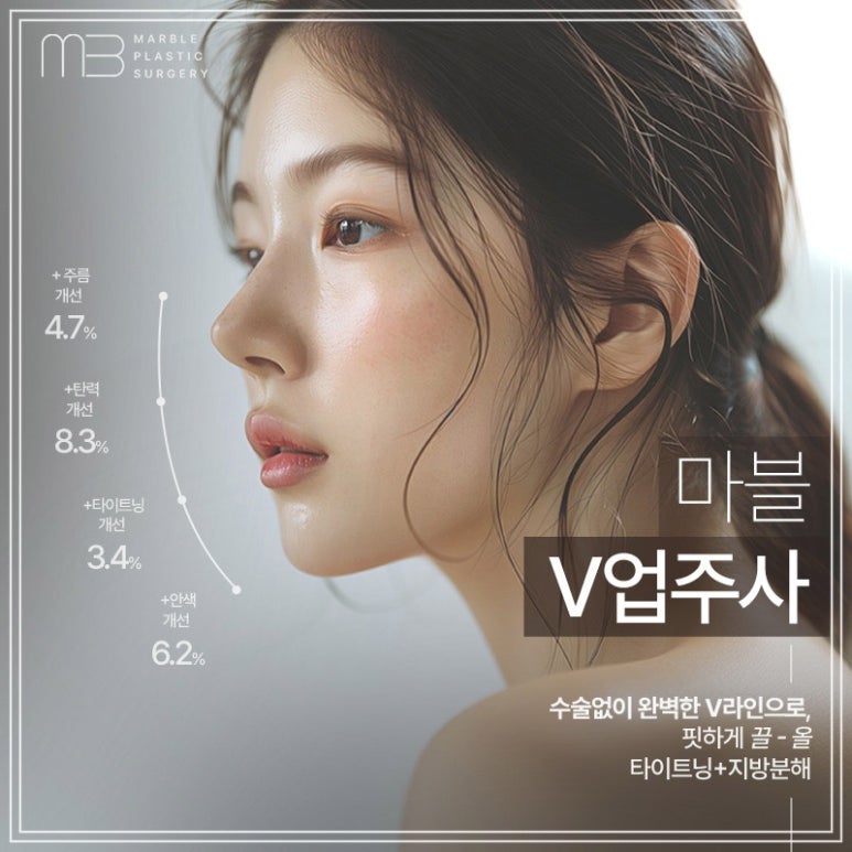 V업주사 윤곽주사와 마블성형외과 가을쁘띠이벤트 진행 중! 관련 이미지 5