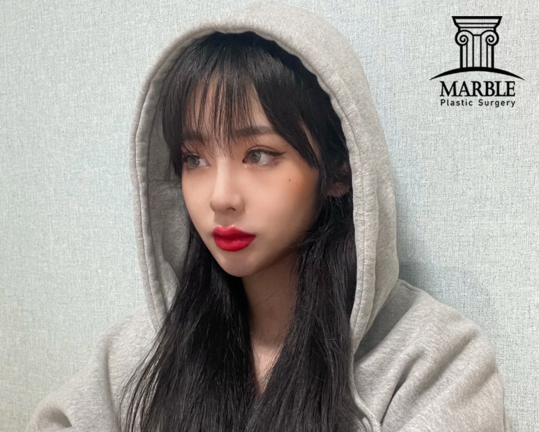 듀얼트임, 자연스럽게 예뻐지는 방법! 마블성형외과의원 관련 이미지 9