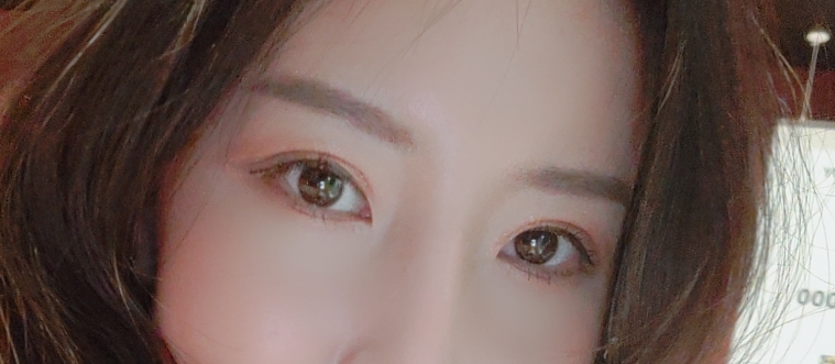 자연유착쌍꺼풀 흉터 풀림 고민 말고 내추럴함!마블성형외과의원 관련 이미지 3