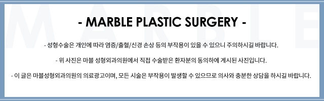 눈재수술비용 및 고려할 점 관련 이미지 11