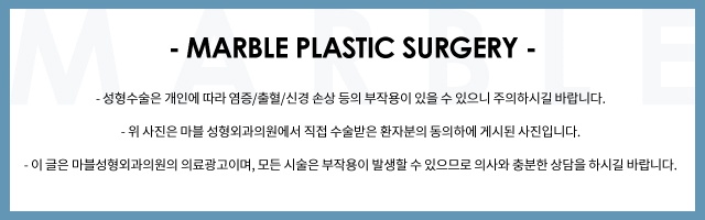 쌍수절개 좋은 선택을 하는 방법 관련 이미지 7
