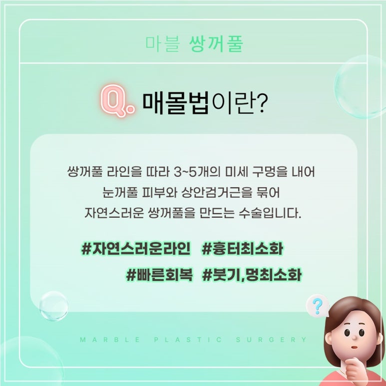 고등학생쌍수 마블이벤트에서 확인, 성형붓기빼는법은 덤으로 관련 이미지 2