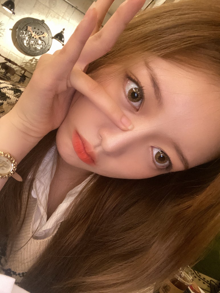눈밑지방재배치 알아가는 정보! 마블성형외과의원 관련 이미지 8