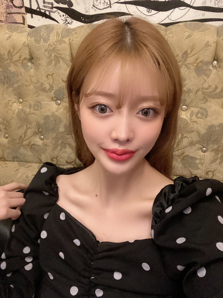 비절개눈매교정 개인 차이에 따라 마블성형외과의원 관련 이미지 5