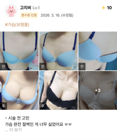 [Marvel Plastic Surgery Breast Augmentation Review] I had surgery because my breasts were completely flat, and I’m so satisfied that I feel like I should have done it sooner! image 1