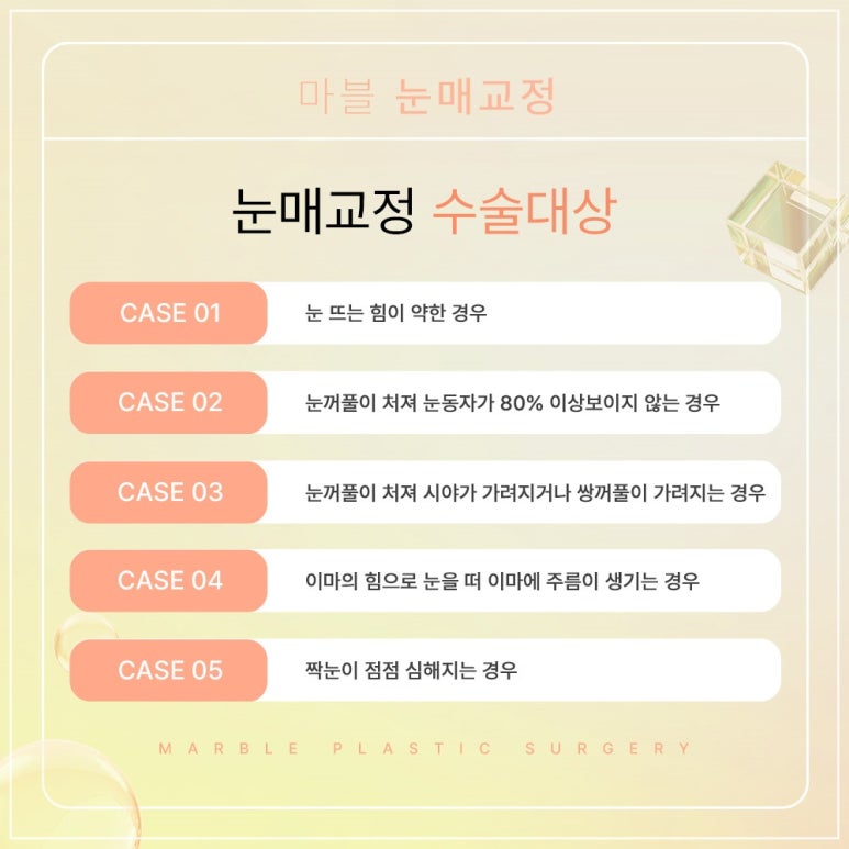 강남역 고등학생눈매교정잘하는곳, 시술방법, 장점, 필요성 관련 이미지 6