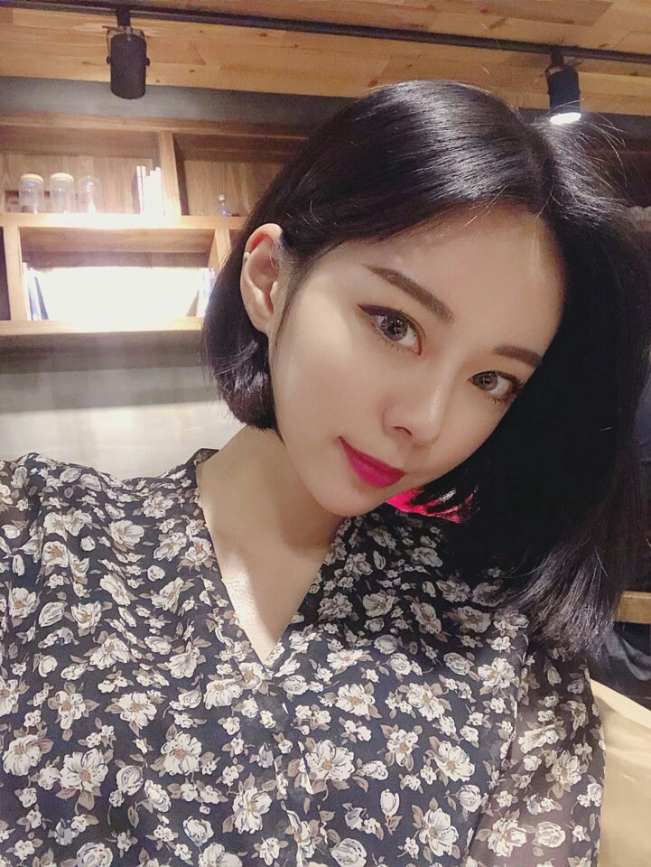 쌍수 눈매교정 앞트임 Q&A!마블성형외과의원 관련 이미지 5