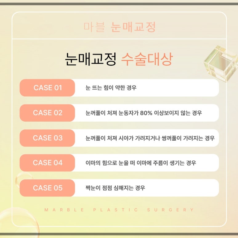 눈매교정 수술, 나도 필요한가? 관련 이미지 5