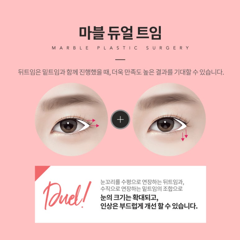 뒤트임후기로 보는 수술 전 참고사항 관련 이미지 3
