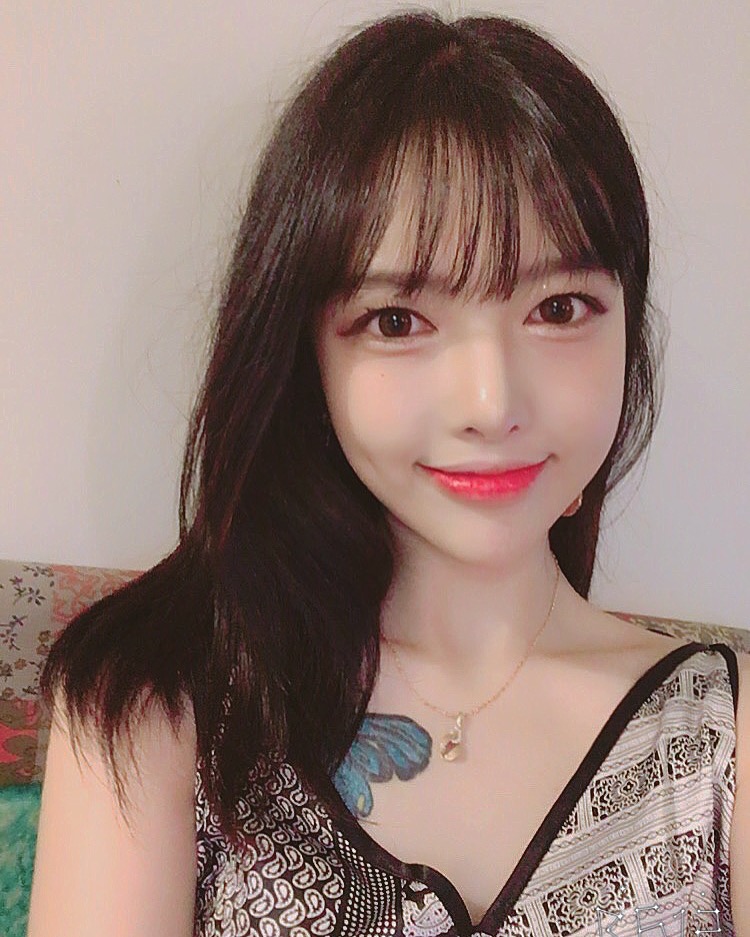 쌍수 눈매교정 앞트임 Q&A!마블성형외과의원 관련 이미지 6
