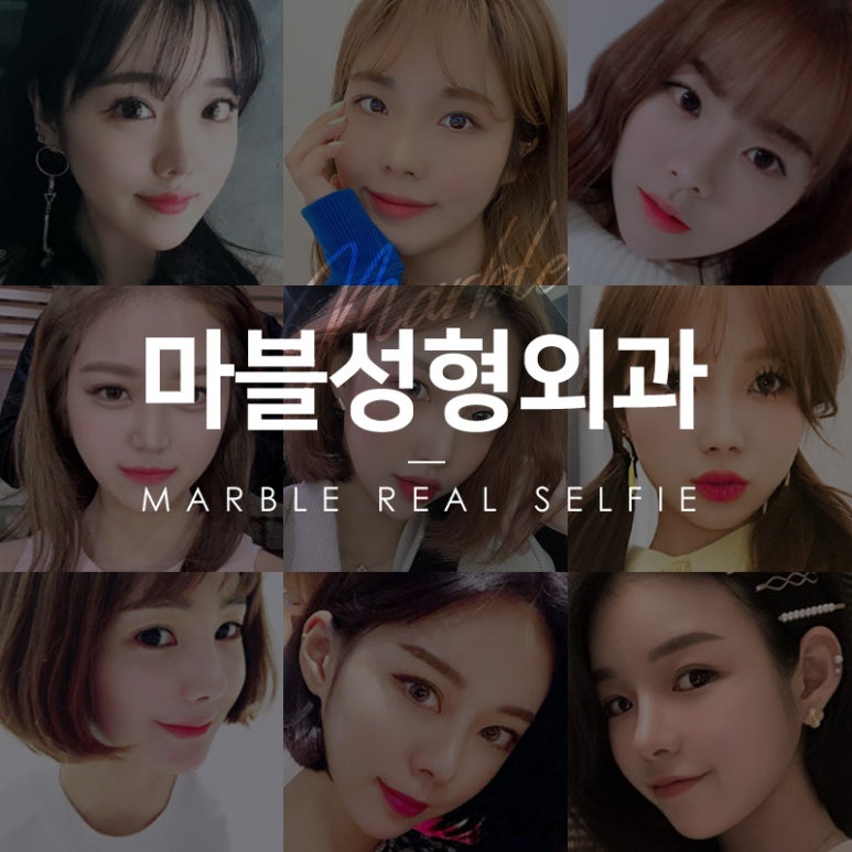 눈매교정 또렷하고 시원한 눈매로! 마블성형외과의원 관련 이미지 14