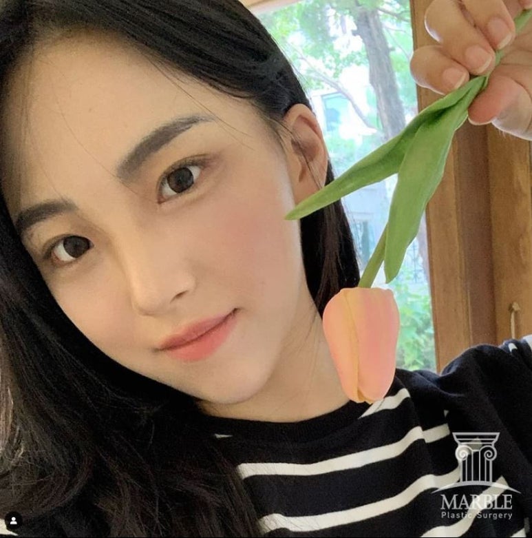 자연유착법 세련된 눈매라인으로 관련 이미지 2