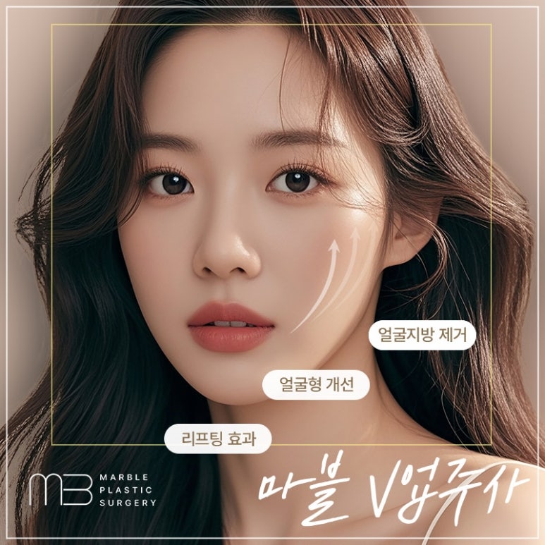 Marvel Plastic Surgery Clinic V-Up Injection Contouring Injection Review and Experience (Before-and-After Photos O) image 1