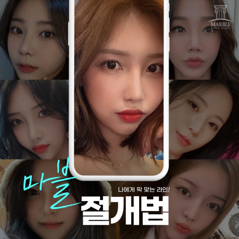 쌍수전후 달라진 눈매 기대한다면 관련 이미지 5