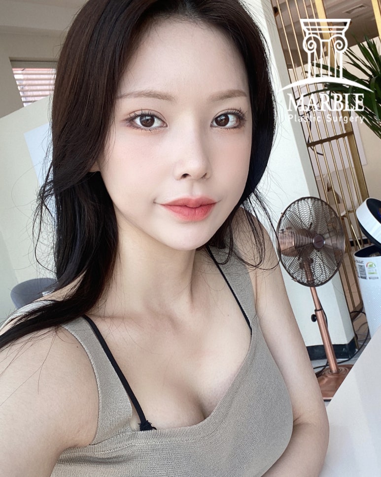 눈수술(눈성형) 후, 알아두면 좋은 주의사항 정리! 관련 이미지 7