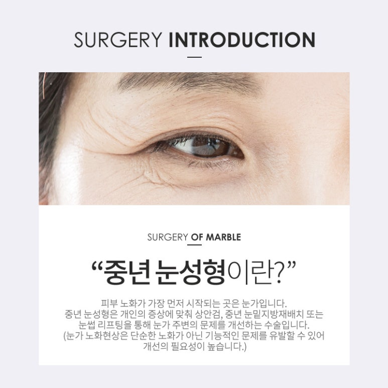 중년눈성형 알맞는 방법으로 해야합니다! 관련 이미지 2