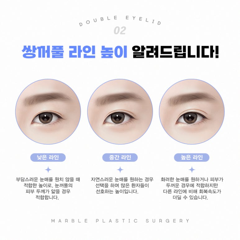 첫눈성형 성공 확률 높이기 위해서 관련 이미지 3