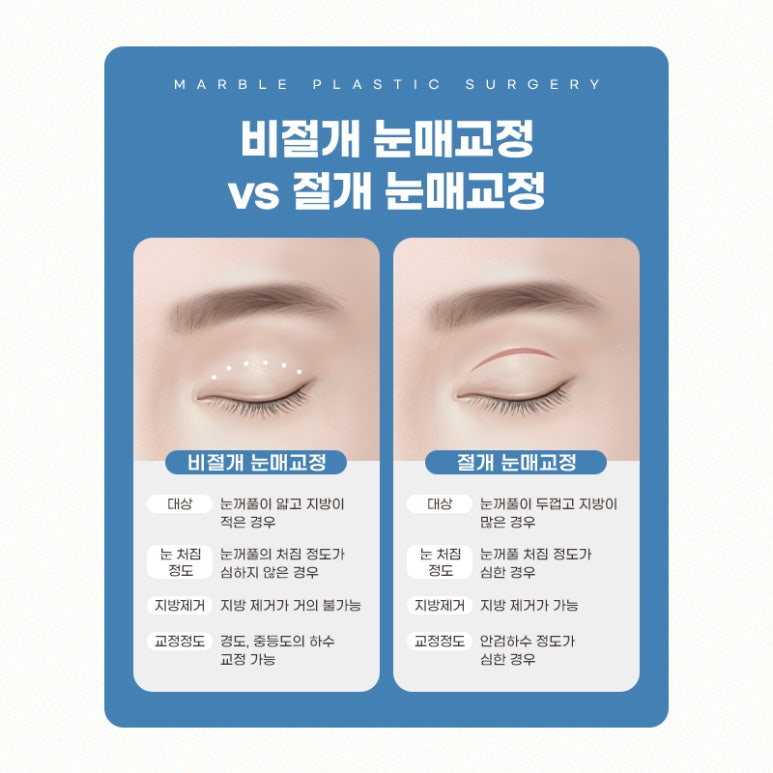 강남눈매교정 더 또렷하게 마블성형외과의원 관련 이미지 8